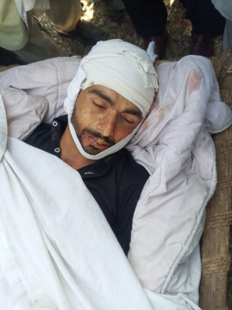 Young Man Killed in Village Bail, UC Bait Gali Young Man Killed in Village Bail, UC Bait Gali