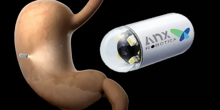 AI Capsule used for fast stomach and intestinal diagnosis in China