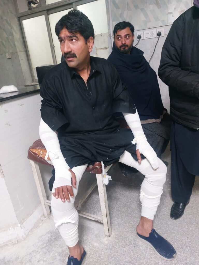 PTI lawyer Ali Zaman after the alleged abduction incident in Rawalpindi.