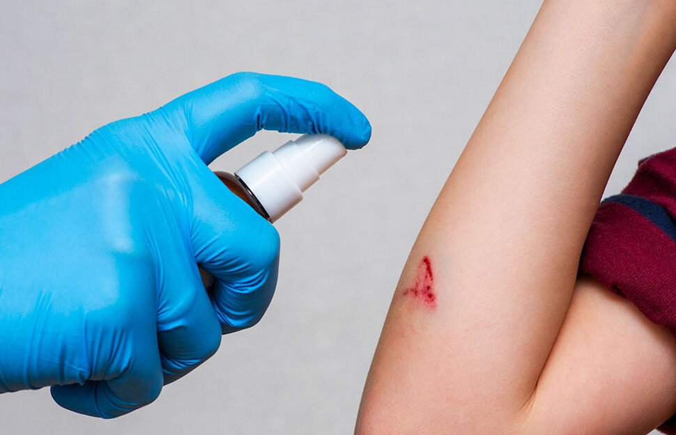 Korean scientists develop spray that seals severe wounds in under a second