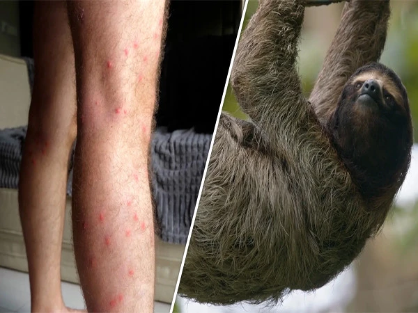 Scientists warn of wider spread of Oropouche virus as infections may be far higher than expected Scientists studying mosquito-borne Oropouche virus spread and health risks in Latin America based on recent medical research.