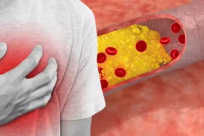 Myqorzo tablets approved in the UK for treating obstructive hypertrophic cardiomyopathy.