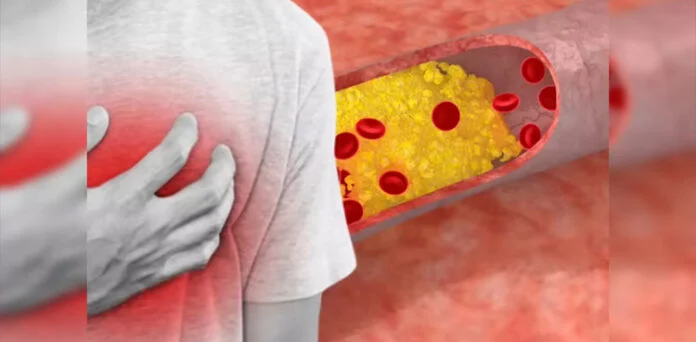 New Heart Drug That Could Benefit Thousands of Patients Myqorzo tablets approved in the UK for treating obstructive hypertrophic cardiomyopathy.