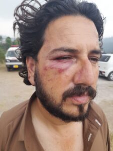 Banned Joint Awami Action Committee members torture Arja traders' leader for six hours