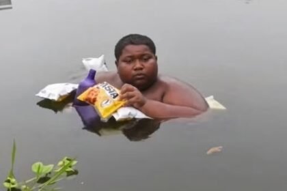 A 16-year-old boy reportedly spends time submerged in a pond because of severe skin discomfort.