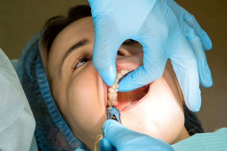 A dental X-ray showing an impacted wisdom tooth associated with pain and swelling.