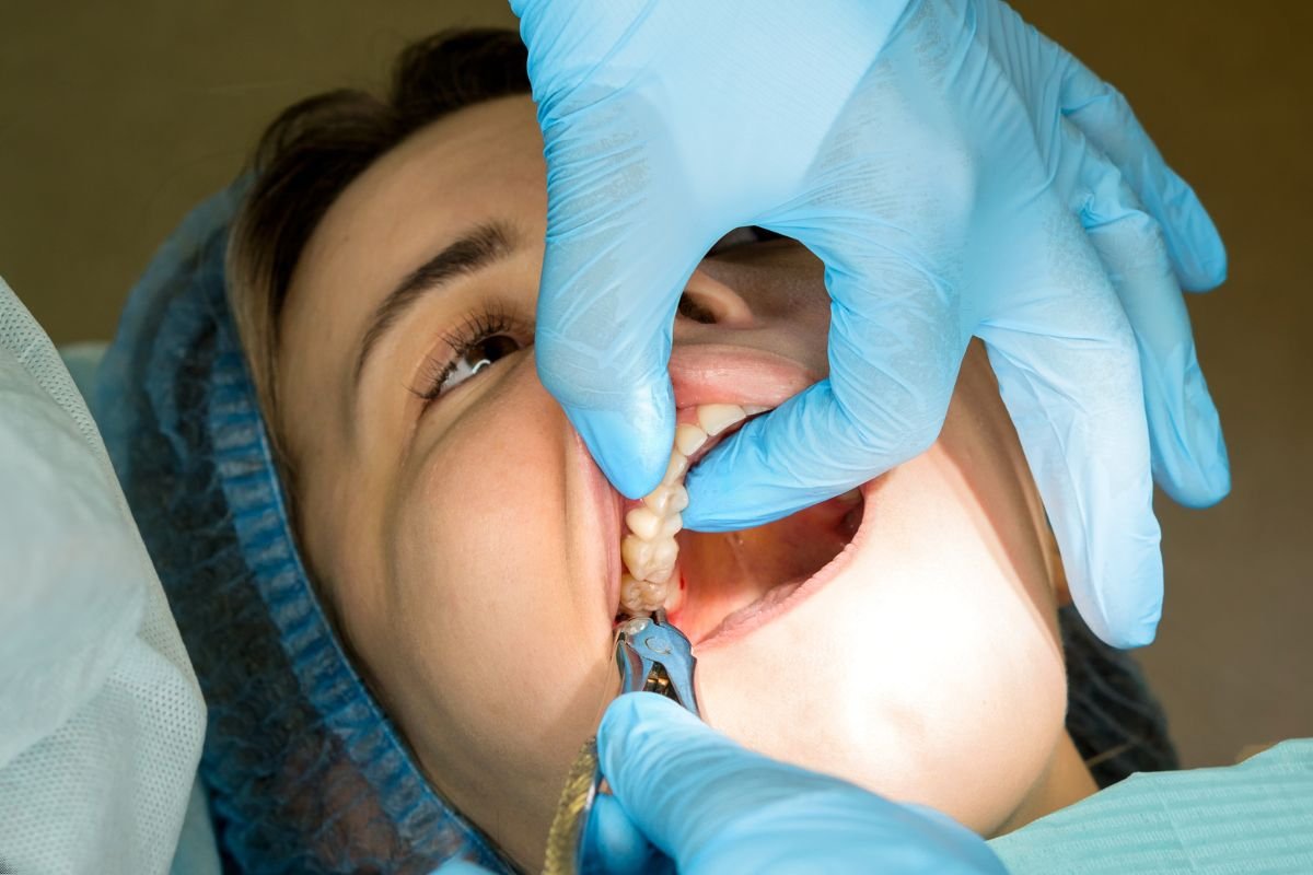Wisdom Teeth Pain: Key Symptoms, Causes and When Treatment Is Needed