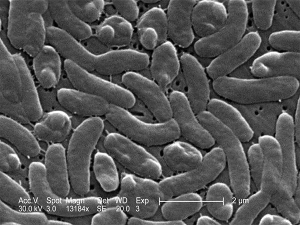 Florida Reports Another Death From Dangerous Bacteria