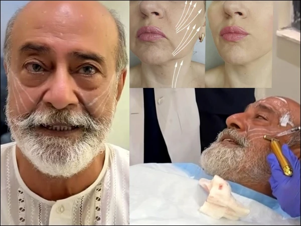 Muhammad Ahmed’s Cosmetic Treatment Sparks Debate Over Ageing and Beauty