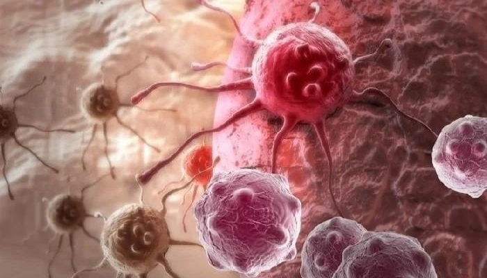 Sitting Too Long May Raise Risk of Cancer Death, Study Finds