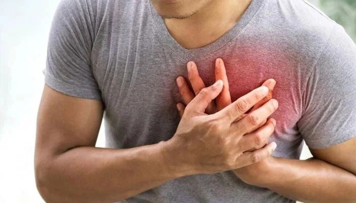 Yellowish Deposits Around Eyes May Signal Higher Heart Disease Risk