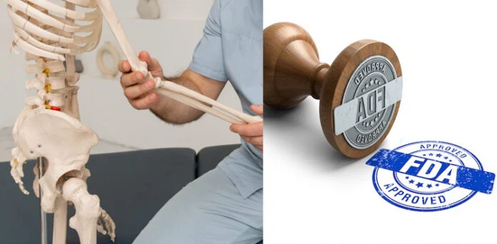 FDA Approves New Drug for Rare Bone-Forming Disorder FOP