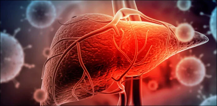 New Hope for Hepatitis D Patients?