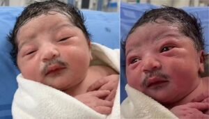 Newborn With a Moustache? Video Stuns Social Media