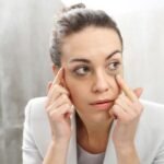 Dark circles under the eyes and possible signs of iron deficiency.
