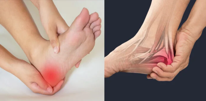 Heel Pain Warning Signs