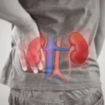 Kidney inflammation can cause symptoms including fever, back pain, burning urination and frequent urination.
