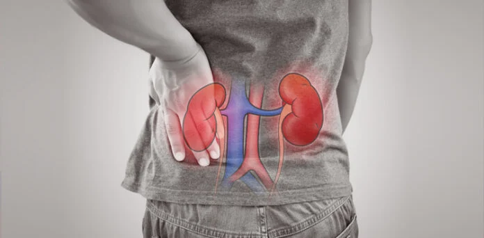 Kidney inflammation can cause symptoms including fever, back pain, burning urination and frequent urination.