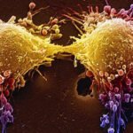 New Prostate Cancer Drug Shows Promising Early Results