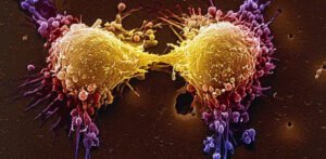 New Prostate Cancer Drug Shows Promising Early Results