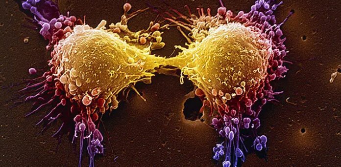 New Prostate Cancer Drug Shows Promising Early Results New Prostate Cancer Drug Shows Promising Early Results