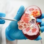 Ultra-processed foods linked to chronic kidney disease risk