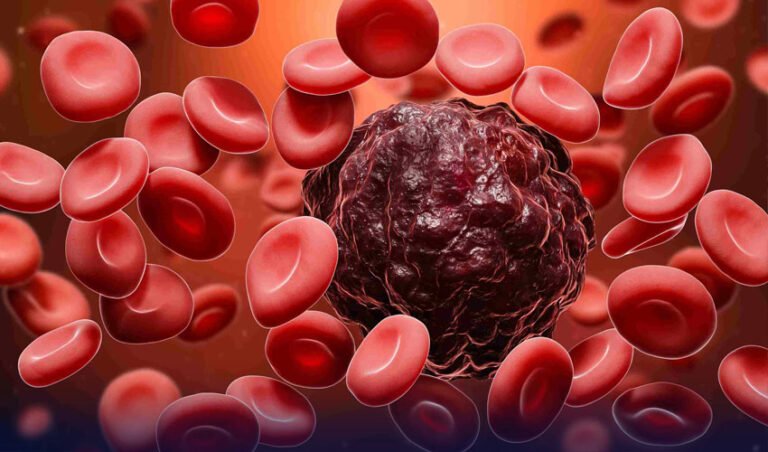 Global Cancer Cases Could Rise 77%