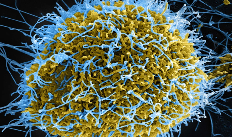 EV-D68 respiratory virus linked to rare polio-like illness in children