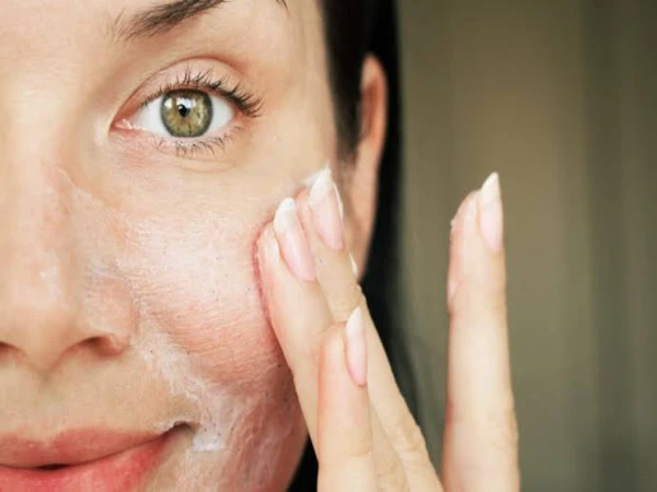 5 easy winter skincare tips to prevent dry skin