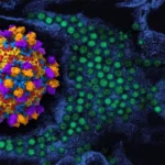 EV-D68 respiratory virus activity rises among children in California